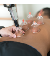 Book an Appointment with Cupping Therapy at BMSWC